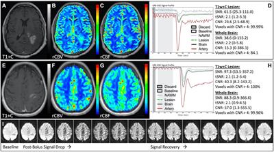 Practical guidance to identify and troubleshoot suboptimal DSC-MRI results